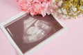 Ultrasound scan and flowers on pink background pregnancy and motherhood concept, conscious parenthood