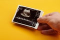 Ultrasound scan with future baby parameters Royalty Free Stock Photo