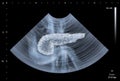 Ultrasound scan of human Pancreas