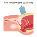 Ultrasound scanning. Male pelvic inner organs research. Urinary system Royalty Free Stock Photo