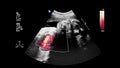 Ultrasound examination of the fetal heart