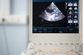 The ultrasound screen with the image of a heart scan with a doppler