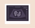 Ultrasound of twins. Embryos in womb. Pregnancy screening. Babies health diagnostic. Fetus silhouettes photo. Sonography