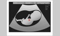 Ultrasound of unborn baby in mother`s womb, medical concept, vector illustration.