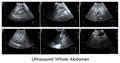 Ultrasound whole abdomen