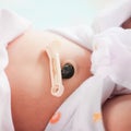 Umbilical cord with clamp of newborn baby