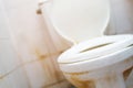Unclean Dirty Old Toilet Bowl In The Bathroom. Is A Collection Of Germs Disease Bacteria.