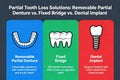 Understanding Solutions for Partial Tooth Loss Removable Denture Vs Alternatives Royalty Free Stock Photo