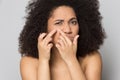 African American girl unhappy with skin squeezing pimples Royalty Free Stock Photo