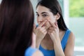 Unhappy woman with skin irritation cleaning her face Royalty Free Stock Photo