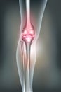 Unhealthy Human leg joint