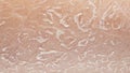 Unhealthy human skin epidermis texture with flaking and cracked Royalty Free Stock Photo