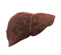 Unhealthy Liver Anatomy Isolated
