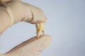 Poor unhealthy tooth removed in the dentist`s hand in the glove