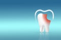 Unhealthy tooth white molar model and Protective vortex around tooth on pastel blue background. Tooth symbol sign. Caries. Caries