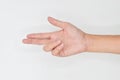 Unilateral DupuytrenÃ¢â¬â¢s contracture in Asian young man. Unilateral hand abnormality