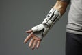 Unleashing Potential: Futuristic Bionic arm Prosthesis Empowers Rehabilitation for the Disabled