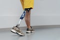 Unrecognisable male in yellow coloured shorts wearing prosthetic leg