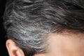 Up close view of a mans hair displaying dandruff issues