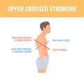 Crooked man with upper crossed syndrome imbalance