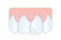 Upper front teeth, incisors. Dentistry, dental care. Vector illustration for study guide or booklet