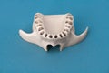 Upper human jaw without teeth model medical implant isolated on blue background. Healthy teeth, dental care and Royalty Free Stock Photo