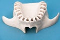 Upper human jaw without teeth model medical implant  on blue background. Healthy teeth, dental care and Royalty Free Stock Photo