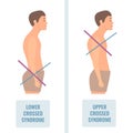 Lower and upper crossed syndrome body diagram