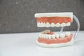 Upper and lower jaw dental model Royalty Free Stock Photo