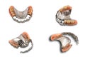 Upper partial metal swinglock type denture