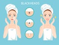 Upset woman with female facial skin problem needs to care about: infographic of clogged nose pores and blackheads. Stages of tr