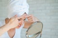 An upset woman looks in the mirror and squeezes a pimple on her forehead. A girl with hormonal problems cleanses her Royalty Free Stock Photo