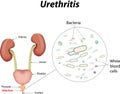 Urethritis Royalty Free Stock Photo