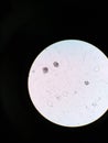 Uric Acid crystals in urine microscopic