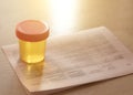 Urinalysis, Drug Testing, Drug. Plastic jars for medical tests.. Urine test