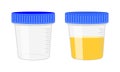 Urinalysis. Urine sample, empty and full plastic containers. Laboratory examination and diagnostics concept. Vector