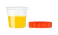 Urinalysis. Urine sample, full open plastic container with removed cover. Laboratory examination and diagnostics concept