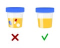 Urinalysis, urine samples with and without drugs. Doping control in sport, post accident drug testing concept. Vector