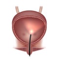 Urinary bladder examination