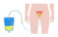 Urinary drainage bag