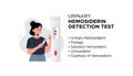 Urinary Hemosiderin Detection Test Royalty Free Stock Photo