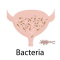 Urinary tract infection. Bacteria
