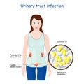 Urinary tract infection. cystitis, and pyelonephritis