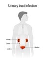 Urinary Tract Infection. pyelonephritis.