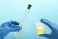 Urine analysis in the laboratory. Medical urine test. Urine sample for laboratory analysis Royalty Free Stock Photo