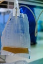 Urine bag hanging beside the patient`s bed.