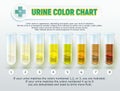 Urine Color Chart 1 Royalty Free Stock Photo