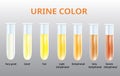 Urine color chart, Urine in Test tubes, medical vector Royalty Free Stock Photo