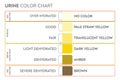 Urine color chart .