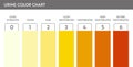 Urine color chart . Royalty Free Stock Photo